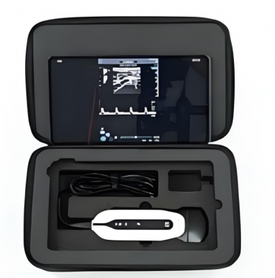 全數字掌上彩色多普勒超聲診斷儀sonoeye p1ws廠家